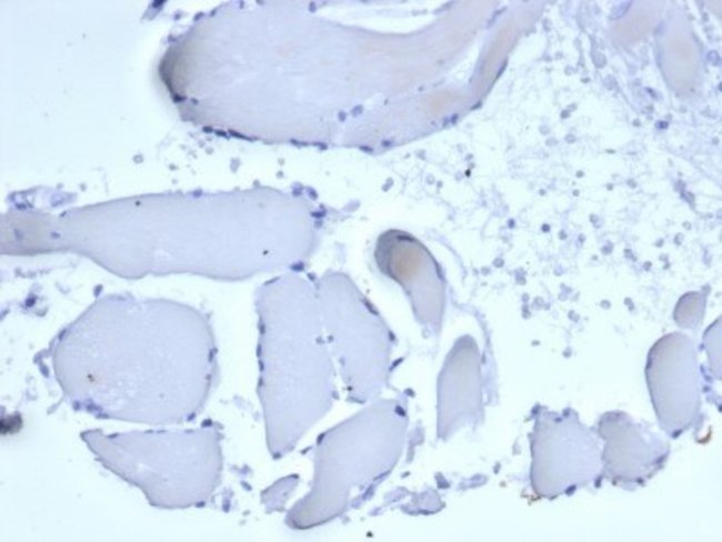 Mammaglobin A Antibody (rMGB/6619) Azide and BSA Free Novus