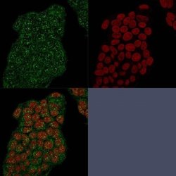 Mammaglobin A Rabbit anti-Human, Clone: MGB/2682R, Novus Biologicals 20