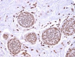 Mammaglobin A Rabbit anti-Human, Clone: MGB/2682R, Novus Biologicals 20