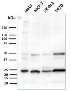 Mammaglobin A Rabbit anti-Human, Clone: MGB/2682R, Novus Biologicals 20