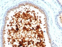 Mammaglobin A Antibody (MGB/4811R) - Azide and BSA Free, Novus Biologicals 100 &mu;g | Buy Online | Novus Biologicals | Fisher Scientific