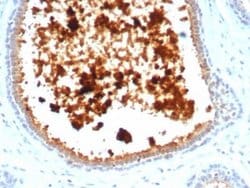 Mammaglobin A Rabbit anti-Human, Clone: MGB/4811R, Novus Biologicals 20