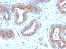 Mammaglobin A Antibody (rMGB/4299) - Azide and BSA Free, Novus Biologicals