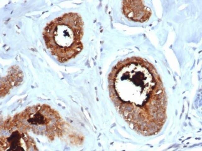 Mammaglobin A Antibody (rMGB/6619) Azide and BSA Free Novus