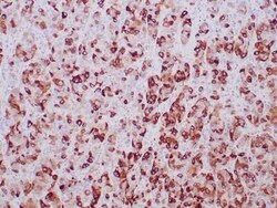 Mammaglobin A Antibody (MGB/2000), Novus Biologicals 100 &mu;g | Buy Online | Novus Biologicals | Fisher Scientific