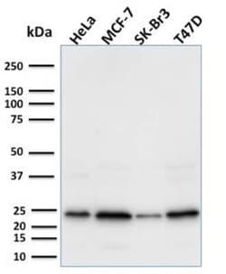 Mammaglobin A Antibody (MGB/2000), Novus Biologicals 100 &mu;g | Buy Online | Novus Biologicals | Fisher Scientific