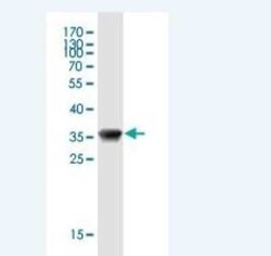 Mammaglobin B Antibody (1G10), Novus Biologicals 0.1 mg | Buy Online | Novus Biologicals | Fisher Scientific