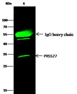 Marapsin/Pancreasin Rabbit anti-Human, Clone: 107, Novus Biologicals:Antibodies:Primary