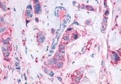 Mas Antibody, Novus Biologicals 50 &mu;g; Unconjugated:Antibodies, Polyclonal