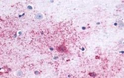 Mas Antibody, Novus Biologicals 50 &mu;g; Unconjugated:Antibodies, Polyclonal
