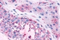 Mas Antibody, Novus Biologicals 50 &mu;g; Unconjugated:Antibodies, Polyclonal
