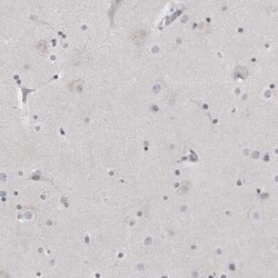 Matrilin-1 Antibody, Novus Biologicals:Antibodies:Primary Antibodies