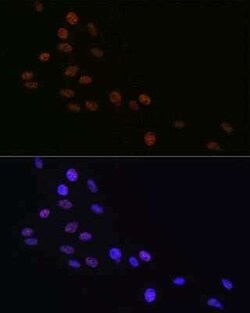 Matrin 3 Rabbit anti-Human, Mouse, Rat, Clone: 10O1D1, Novus Biologicals:Antibodies:Primary