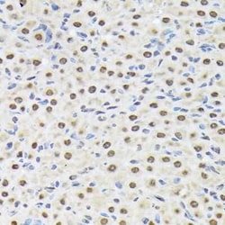 Matrin 3 Rabbit anti-Human, Mouse, Rat, Clone: 10O1D1, Novus Biologicals:Antibodies:Primary