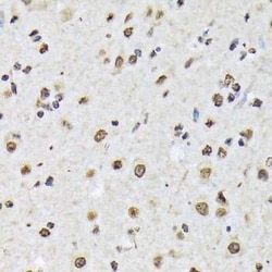Matrin 3 Rabbit anti-Human, Mouse, Rat, Clone: 10O1D1, Novus Biologicals:Antibodies:Primary