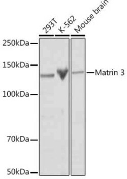 Matrin 3 Rabbit anti-Human, Mouse, Rat, Clone: 10O1D1, Novus Biologicals:Antibodies:Primary