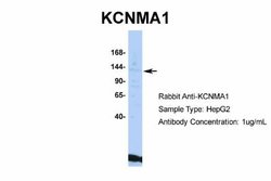 Maxi Potassium channel alpha Antibody, Novus Biologicals 100 &mu;L; Unconjugated:Antibodies,
