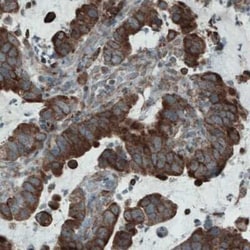 Mcl-1 Antibody (CL1128), Novus Biologicals 25 &mu;L | Buy Online | Novus Biologicals | Fisher Scientific