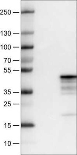 Mcl-1 Antibody (CL1128), Novus Biologicals 25 &mu;L | Buy Online | Novus Biologicals | Fisher Scientific