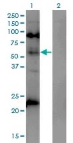 MeCP2 Antibody (4B6), Novus Biologicals 0.1 mg | Buy Online | Novus Biologicals | Fisher Scientific