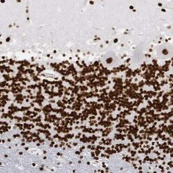 MeCP2 Antibody, Novus Biologicals:Antibodies:Primary Antibodies