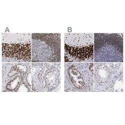 MeCP2 Antibody, Novus Biologicals:Antibodies:Primary Antibodies