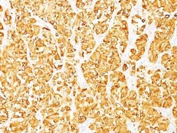 Melan-A/MART-1 Antibody (M2-7C10), Novus Biologicals:Antibodies:Primary