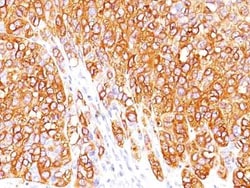 Melan-A/MART-1 Antibody (M2-7C10), Novus Biologicals:Antibodies:Primary