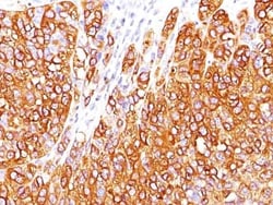Melan-A/MART-1 Antibody (M2-7C10), Novus Biologicals:Antibodies:Primary