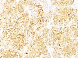 Melan-A/MART-1 Antibody (M2-9E3), Novus Biologicals:Antibodies:Primary