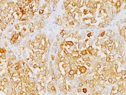 Melan-A/MART-1 Antibody (M2-9E3), Novus Biologicals:Antibodies:Primary