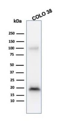 Melan-A/MART-1 Antibody (M2-9E3), Novus Biologicals:Antibodies:Primary