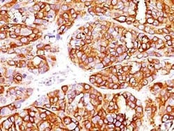 Melan-A/MART-1 Antibody (MLANA/1409R), Novus Biologicals:Antibodies:Primary
