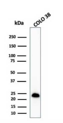 Melan-A/MART-1 Antibody (MLANA/1409R), Novus Biologicals:Antibodies:Primary