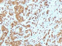 Melan-A/MART-1 Antibody (MLANA/788), Novus Biologicals 0.02 mg | Buy Online | Novus Biologicals | Fisher Scientific