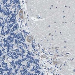 Melanocortin-4 R Antibody, Novus Biologicals 25 &mu;L | Buy Online | Novus Biologicals | Fisher Scientific