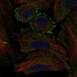 Melanocortin-5 R/MC5R Rabbit anti-Human, Polyclonal, Novus Biologicals:Antibodies:Primary