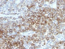Melanoma Associated Antigen (PNL2) Antibody (PNL2), Novus Biologicals 0.02mg;