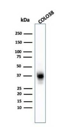 Melanoma Marker (MART-1 + Tyrosinase + gp100) Antibody (A103 + T311 + HMB45) - Azide and BSA Free, Novus Biologicals 0.1 mg | Buy Online | Novus Biologicals | Fisher Scientific