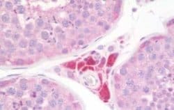 Melatonin R1A/MT1/MTNR1A Antibody, Novus Biologicals 50 &mu;g | Buy Online | Novus Biologicals | Fisher Scientific