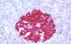 Melatonin R1A/MT1/MTNR1A Antibody, Novus Biologicals 50 &mu;g | Buy Online | Novus Biologicals | Fisher Scientific