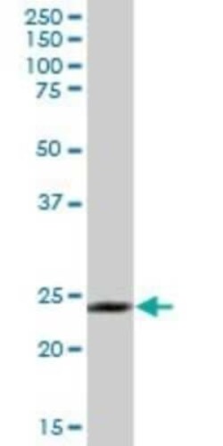 Membrin Antibody, Novus Biologicals 0.05 mg | Buy Online | Novus Biologicals | Fisher Scientific