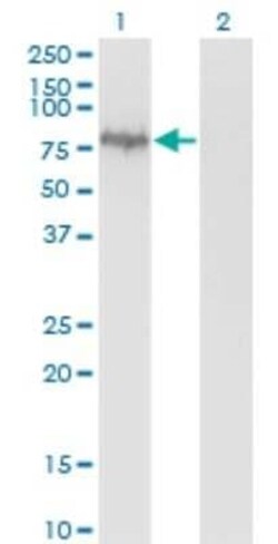 Mena Antibody (3E6), Novus Biologicals 0.1 mg | Buy Online | Novus Biologicals | Fisher Scientific