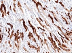 Meprin alpha Subunit/MEP1A Rabbit anti-Mouse, Clone: 1, Novus Biologicals
