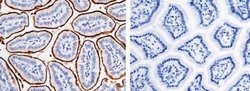 Meprin alpha Subunit/MEP1A Rabbit anti-Mouse, Clone: 1, Novus Biologicals