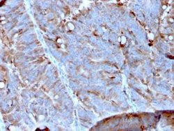 Mer Mouse anti-Human, Clone: MERTK/3023, Novus Biologicals:Antibodies:Primary
