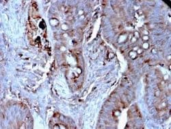 Mer Mouse anti-Human, Clone: MERTK/3024, Novus Biologicals 100 &mu;g; Unconjugated:Antibodies,