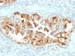 Mesothelin Antibody (MSLN/2131) - Azide and BSA Free, Novus Biologicals