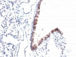 Mesothelin Antibody (MSLN/2131) - Azide and BSA Free, Novus Biologicals