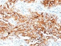 Mesothelin Antibody (MSLN/2131) - Azide and BSA Free, Novus Biologicals